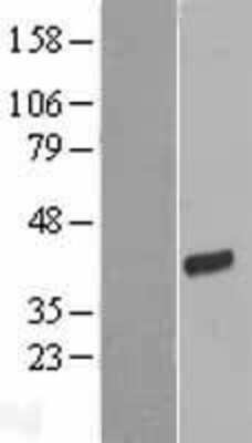 Western Blot: FRG1 Overexpression Lysate (Adult Normal) [NBP2-07869] Left-Empty vector transfected control cell lysate (HEK293 cell lysate); Right -Over-expression Lysate for FRG1.