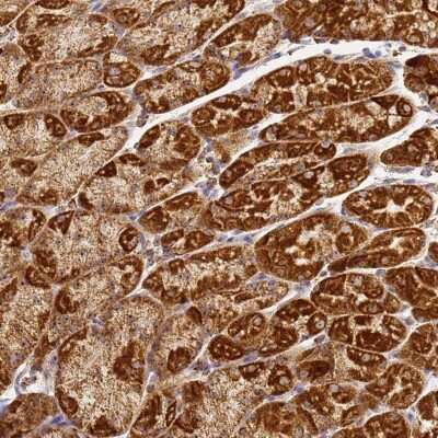 Immunohistochemistry: FRG2B Antibody [NBP2-32633] - Staining of human stomach, lower shows strong cytoplasmic positivity in glandular cells.