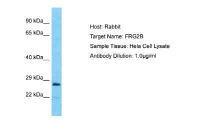 Western Blot: FRG2B Antibody [NBP2-82843] - Host: Rabbit. Target Name: FRG2B. Sample Type: Hela Whole Cell lysates. Antibody Dilution: 1.0ug/ml