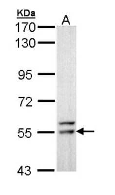 Western Blot: FRK Antibody [NBP1-31636] - Sample (30 ug of whole cell lysate) A: Hep G2 7.5% SDS PAGE; antibody diluted at 1:1000.