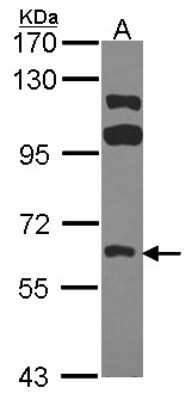 Western Blot: FRK Antibody [NBP2-16534] - Sample (30 ug of whole cell lysate) A: A431 7. 5% SDS PAGE gel, diluted at 1:1000.