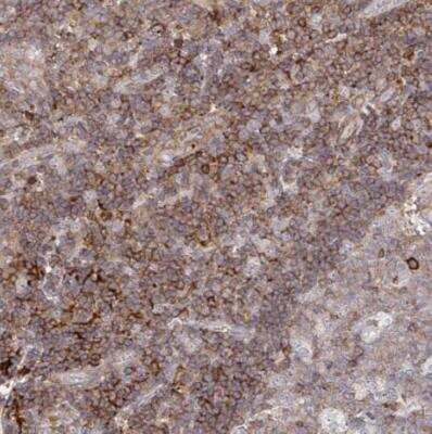 Immunohistochemistry-Paraffin FRMD3 Antibody - BSA Free