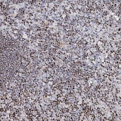 Immunohistochemistry-Paraffin: FRMD4A Antibody [NBP1-90807] - Staining of human lymphoid tissues shows strong nuclear positivity in non-germinal center cells.