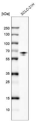 Western Blot: FRMD5 Antibody (CL9503) [NBP2-88935] - Analysis in human cell line SCLC-21H.