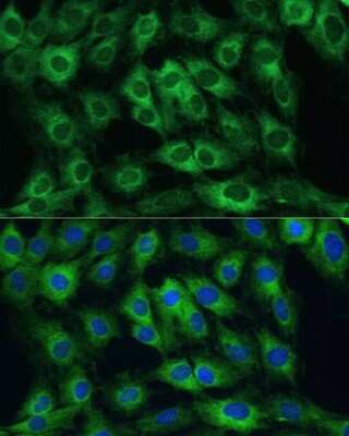 Immunocytochemistry/Immunofluorescence: FRMD6 Antibody [NBP3-05019] - Analysis of C6 cells using FRMD6 antibody at dilution of 1:100. Blue: DAPI for nuclear staining.