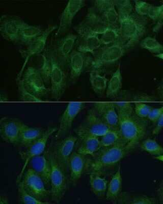 Immunocytochemistry/Immunofluorescence: FRMD6 Antibody [NBP3-05019] - Analysis of U2OS cells using FRMD6 antibody at dilution of 1:100. Blue: DAPI for nuclear staining.