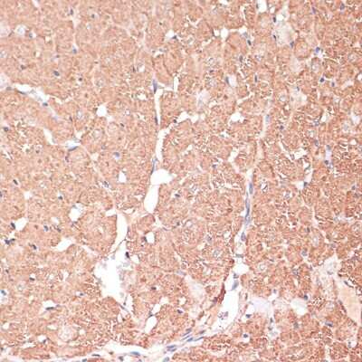 Immunohistochemistry-Paraffin: FRMD6 Antibody [NBP3-05019] - Rat heart using FRMD6 antibody at dilution of 1:100 (40x lens).Perform microwave antigen retrieval with 10 mM PBS buffer pH 7.2 before commencing with IHC staining protocol.