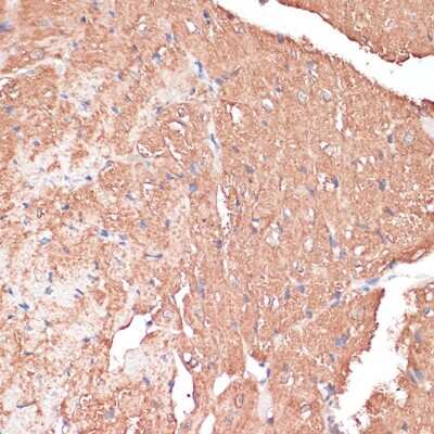 Immunohistochemistry-Paraffin: FRMD6 Antibody [NBP3-05019] - Mouse heart using FRMD6 antibody at dilution of 1:100 (40x lens).Perform microwave antigen retrieval with 10 mM PBS buffer pH 7.2 before commencing with IHC staining protocol.