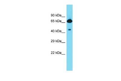 Western Blot FRMD6 Antibody