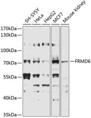 Western Blot: FRMD6 Antibody [NBP3-05019] - Analysis of extracts of various cell lines, using FRMD6 antibody at 1:1000 dilution. Secondary antibody: HRP Goat Anti-Rabbit IgG (H+L) at 1:10000 dilution. Lysates/proteins: 25ug per lane. Blocking buffer: 3% nonfat dry milk in TBST. Detection: ECL Basic Kit