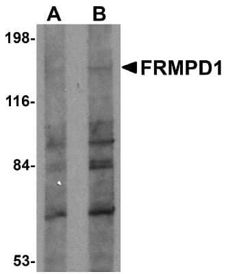 Western Blot: FRMPD1 Antibody [NBP1-77082] - K562 cell lysate with FRMPD1 antibody at (A) 1 and (B) 2 ug/mL.