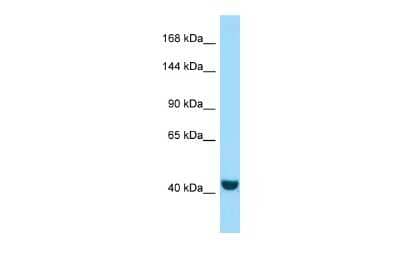 Western Blot: FRMPD2 Antibody [NBP2-86637] - Host: Rabbit. Target Name: FRMPD2. Sample Type: A549 Whole Cell lysates. Antibody Dilution: 1.0ug/ml