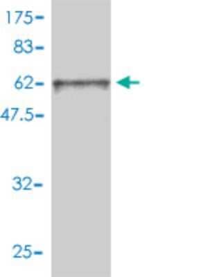 Western Blot: FRS2 Antibody (1F7-1D6) [H00010818-M02]