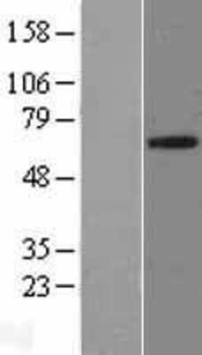 Western Blot: FRS2 Overexpression Lysate (Adult Normal) [NBL1-10836] Left-Empty vector transfected control cell lysate (HEK293 cell lysate); Right -Over-expression Lysate for FRS2.