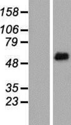 Western Blot: FRS2 Overexpression Lysate (Adult Normal) [NBP2-09242] Left-Empty vector transfected control cell lysate (HEK293 cell lysate); Right -Over-expression Lysate for FRS2.