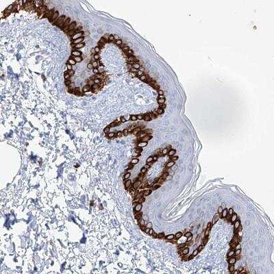 Immunohistochemistry-Paraffin: FRS3 Antibody [NBP1-83420] - Staining of human skin shows strong cytoplasmic positivity in epidermal cells.