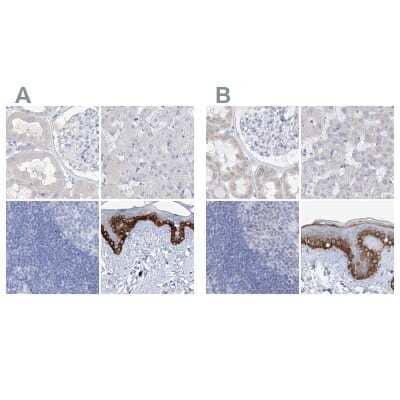 Immunohistochemistry-Paraffin FRS3 Antibody