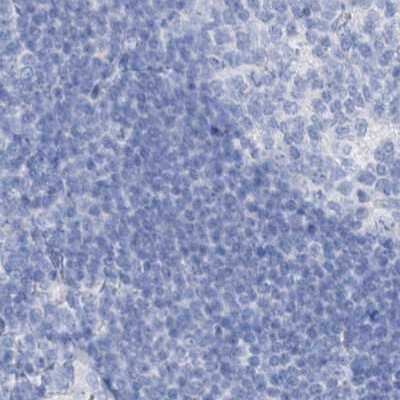 Immunohistochemistry-Paraffin FRS3 Antibody