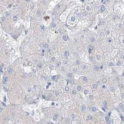 Immunohistochemistry-Paraffin: FRS3 Antibody [NBP1-83420] - Staining of human liver.