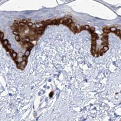 Immunohistochemistry-Paraffin: FRS3 Antibody [NBP1-83420] - Staining of human skin.