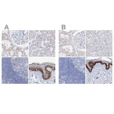 <b>Independent Antibodies Validation. </b>Immunohistochemistry-Paraffin: FRS3 Antibody [NBP1-83421] - Staining of human kidney, liver, lymph node and skin using Anti-FRS3 antibody NBP1-83421 (A) shows similar protein distribution across tissues to independent antibody NBP1-83420 (B).