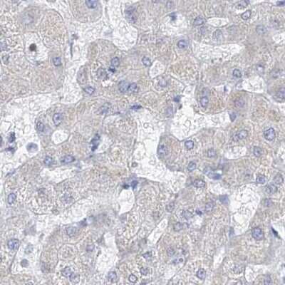 Immunohistochemistry-Paraffin: FRS3 Antibody [NBP1-83421] - Staining of human liver.