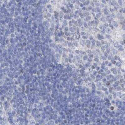 Immunohistochemistry-Paraffin: FRS3 Antibody [NBP1-83421] - Staining of human lymph node.