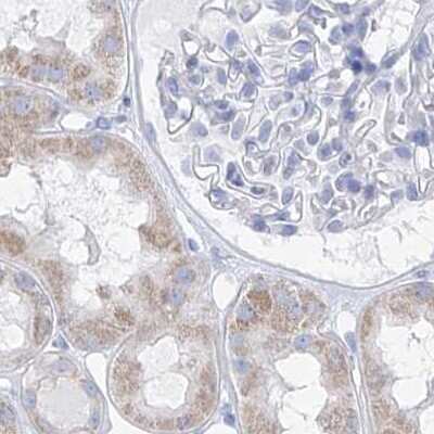 Immunohistochemistry-Paraffin: FRS3 Antibody [NBP1-83421] - Staining of human kidney.