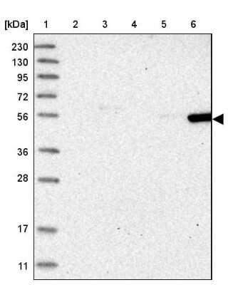 Western Blot: FRS3 Antibody [NBP1-83421] - Lane 1: Marker  [kDa] 230, 130, 95, 72, 56, 36, 28, 17, 11.  Lane 2: Human cell line RT-4.  Lane 3: Human cell line U-251MG sp.  Lane 4: Human plasma (IgG/HSA depleted).  Lane 5: Human liver tissue.  Lane 6: Human tonsil tissue