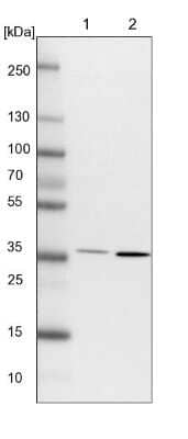 Western Blot: FRYL Antibody [NBP1-94071] - Lane 1: NIH-3T3 cell lysate (Mouse embryonic fibroblast cells). Lane 2: NBT-II cell lysate (Rat Wistar bladder tumor cells).