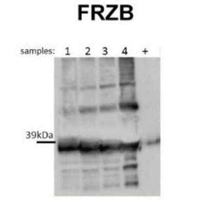 Western Blot: FRZB Antibody [NBP1-79551] - Titration: 0.4 ug/ml Positive Control: human synovium patient.