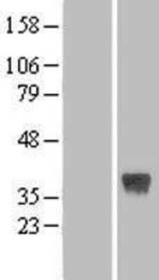 Western Blot: FRZB Overexpression Lysate (Adult Normal) [NBL1-10839] Left-Empty vector transfected control cell lysate (HEK293 cell lysate); Right -Over-expression Lysate for FRZB.