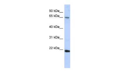 Western Blot FSBP Antibody - BSA Free