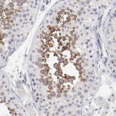 Immunohistochemistry-Paraffin FSCB Antibody - BSA Free