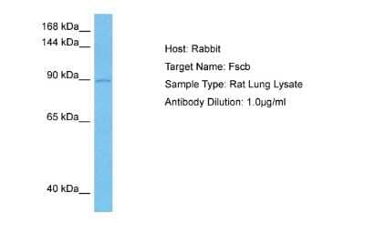 Western Blot: FSCB Antibody [NBP2-82845] - Host: Rabbit. Target Name: FSCB. Sample Tissue: Rat Lung lysates. Antibody Dilution: 1ug/ml