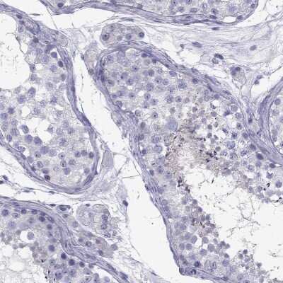 Immunohistochemistry-Paraffin FSCN3 Antibody - BSA Free