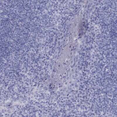 Immunohistochemistry-Paraffin FSCN3 Antibody - BSA Free