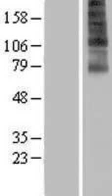 Western Blot FSCN3 Overexpression Lysate