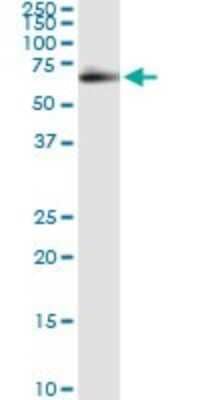 Immunoprecipitation: FSD1 Antibody (1G3) [H00079187-M01] - Analysis of FSD1 transfected lysate using anti-FSD1 monoclonal antibody and Protein A Magnetic Bead, and immunoblotted with FSD1 MaxPab rabbit polyclonal antibody.