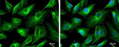 Immunocytochemistry/Immunofluorescence: FSD1 Antibody [NBP3-13039] - FSD1 antibody detects FSD1 protein at cytoskeleton by immunofluorescent analysis. Sample: SK-N-SH cells were fixed in 4% paraformaldehyde at RT for 15 min. Green: FSD1 protein stained by FSD1 antibody (NBP3-13039) diluted at 1:500. Blue: Hoechst 33342 staining. Scale bar = 10 um.