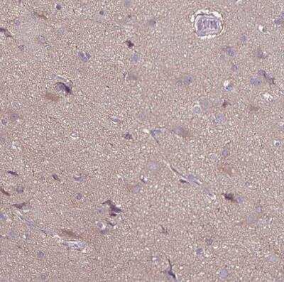 Immunohistochemistry-Paraffin: FSD1 Antibody [NBP1-81123] -  Staining of human cerebral cortex shows moderate positivity in neuropil.