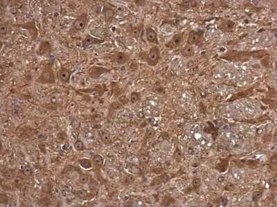 Immunohistochemistry-Paraffin: FSD1 Antibody [NBP3-13039] - FSD1 antibody detects FSD1 protein at cytoplasm and nucleus in mouse brain by immunohistochemical analysis. Sample: Paraffin-embedded mouse brain. FSD1 antibody (NBP3-13039) diluted at 1:1200. Antigen Retrieval: Citrate buffer, pH 6.0, 15 min