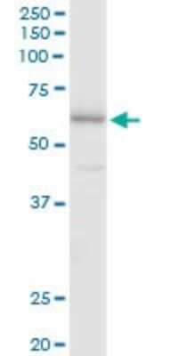 Western Blot: FSD1 Antibody [H00079187-B01P] - Analysis of FSD1 expression in HeLa.
