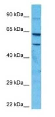 Western Blot: FSD1 Antibody [NBP3-09408] - Western blot analysis of FSD1 in 721_B Whole Cell lysates. Antibody dilution at 1.0ug/ml