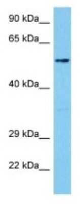 Western Blot: FSD1 Antibody [NBP3-10100] - Western blot analysis of FSD1 in Human 293T Whole Cell lysates. Antibody dilution at 1ug/ml