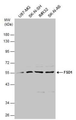 Western Blot: FSD1 Antibody [NBP3-13039] - Various whole cell extracts (30 ug) were separated by 10% SDS-PAGE, and the membrane was blotted with FSD1 antibody (NBP3-13039) diluted at 1:1000.