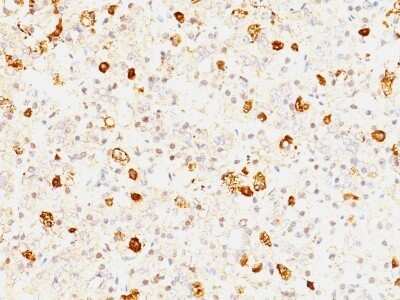 Immunohistochemistry-Paraffin: FSH beta Antibody (FSHb/1062) - Azide and BSA Free [NBP2-47734] - Human Pituitary stained with FSH-beta Monoclonal Antibody (FSHb/1062).