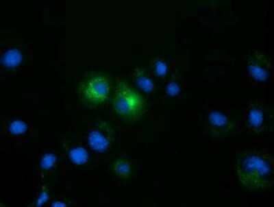 Immunocytochemistry/Immunofluorescence: FSH beta Antibody (OTI2A6) - Azide and BSA Free [NBP2-70781] - Staining of COS7 cells transiently transfected by pCMV6-ENTRY FSH beta.