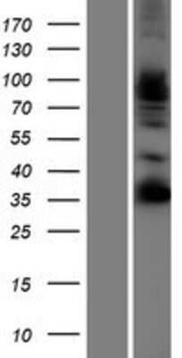 Western Blot: FSTL4 Overexpression Lysate (Adult Normal) [NBP2-07216] Left-Empty vector transfected control cell lysate (HEK293 cell lysate); Right -Over-expression Lysate for FSTL4.