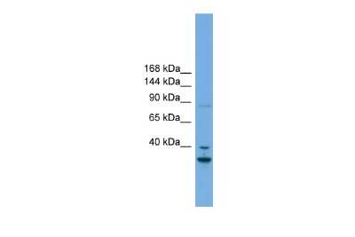 Western Blot: FSTL5 Antibody [NBP2-86638] - WB Suggested Anti-FSTL5 Antibody Titration: 0.2-1 ug/ml. Positive Control: Human heart